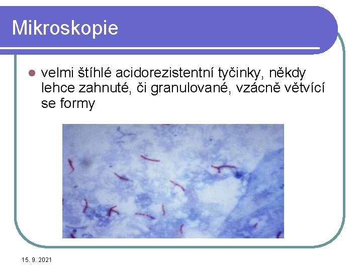 Mikroskopie l velmi štíhlé acidorezistentní tyčinky, někdy lehce zahnuté, či granulované, vzácně větvící se