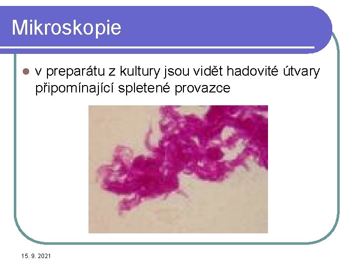 Mikroskopie l v preparátu z kultury jsou vidět hadovité útvary připomínající spletené provazce 15.