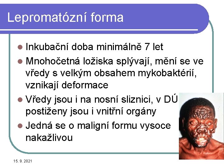 Lepromatózní forma l Inkubační doba minimálně 7 let l Mnohočetná ložiska splývají, mění se