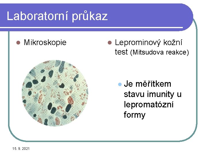 Laboratorní průkaz l Mikroskopie l Leprominový kožní test (Mitsudova reakce) l 15. 9. 2021