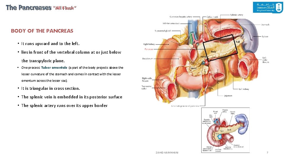 The Pancreases “All Flesh” BODY OF THE PANCREAS • It runs upward and to