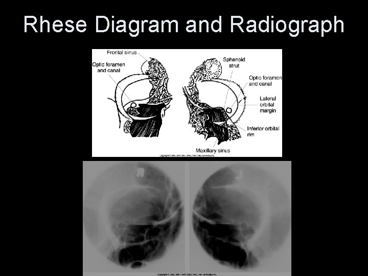 Rhese Diagram and Radiograph 