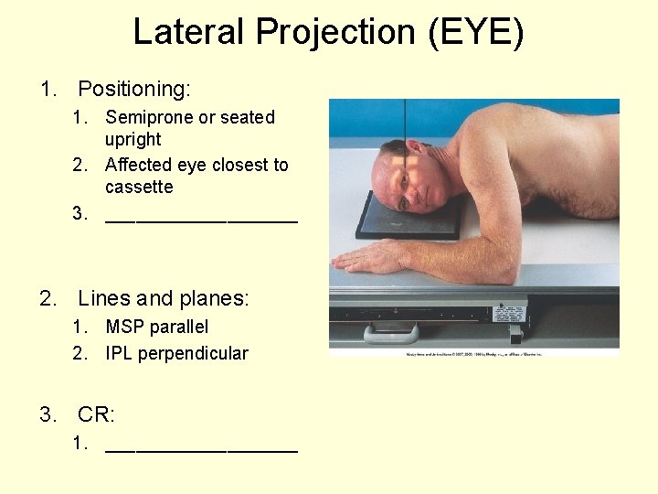 Lateral Projection (EYE) 1. Positioning: 1. Semiprone or seated upright 2. Affected eye closest