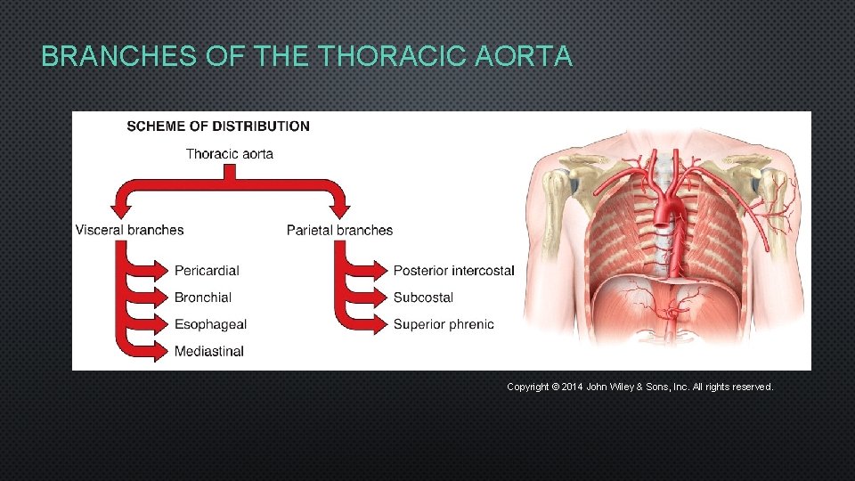 BRANCHES OF THE THORACIC AORTA Copyright © 2014 John Wiley & Sons, Inc. All