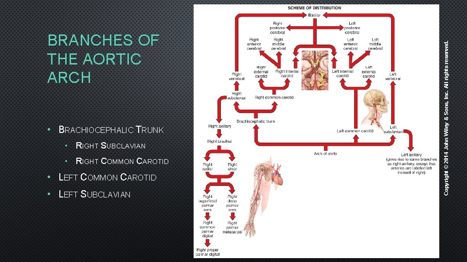  • BRACHIOCEPHALIC TRUNK • RIGHT SUBCLAVIAN • RIGHT COMMON CAROTID • LEFT COMMON