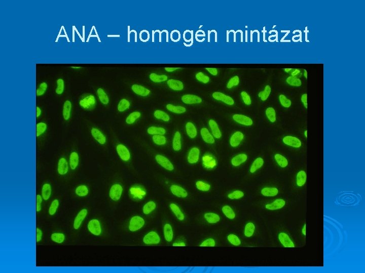 ANA – homogén mintázat ANA – homogén mintázat