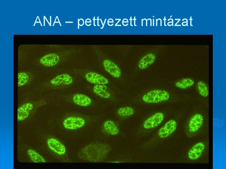 ANA – pettyezett mintázat ANA – pettyezett mintázat