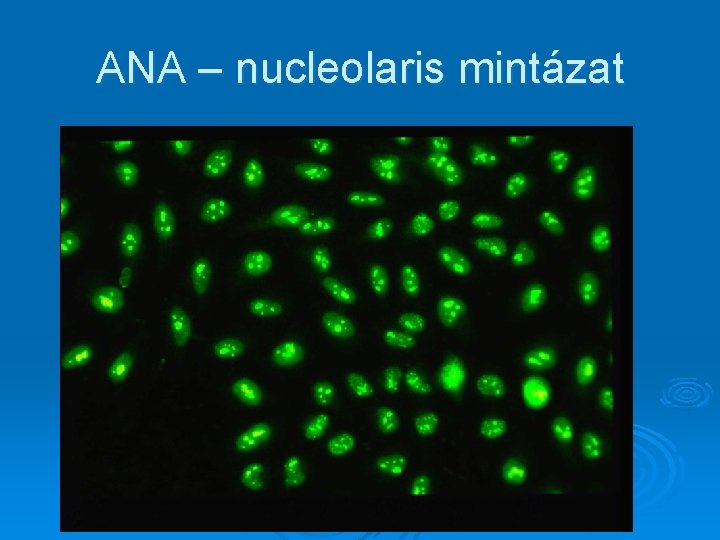 ANA – nucleolaris mintázat ANA – nucleolaris mintázat