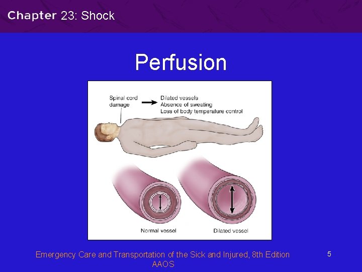 23: Shock Perfusion Emergency Care and Transportation of the Sick and Injured, 8 th