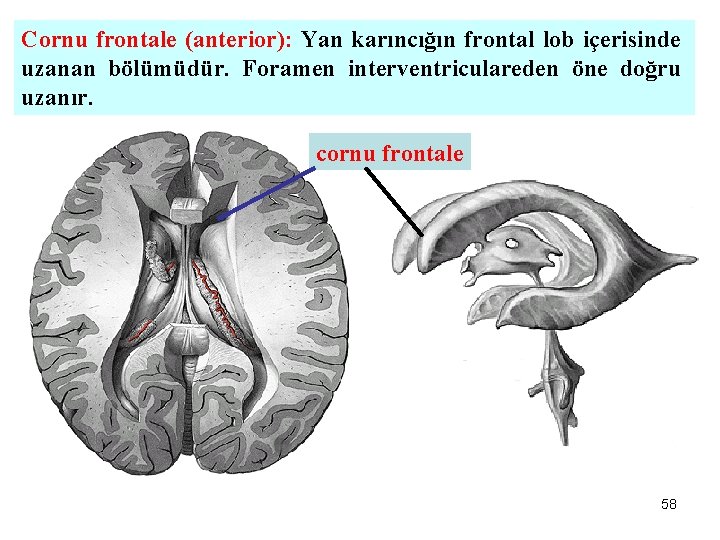 Cornu frontale (anterior): Yan karıncığın frontal lob içerisinde uzanan bölümüdür. Foramen interventriculareden öne doğru