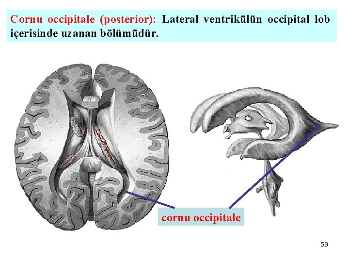 Cornu occipitale (posterior): Lateral ventrikülün occipital lob içerisinde uzanan bölümüdür. cornu occipitale 59 