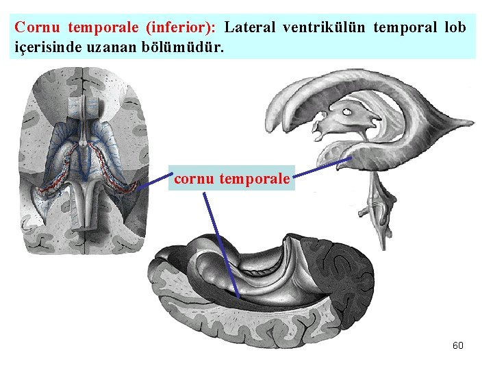 Cornu temporale (inferior): Lateral ventrikülün temporal lob içerisinde uzanan bölümüdür. cornu temporale 60 