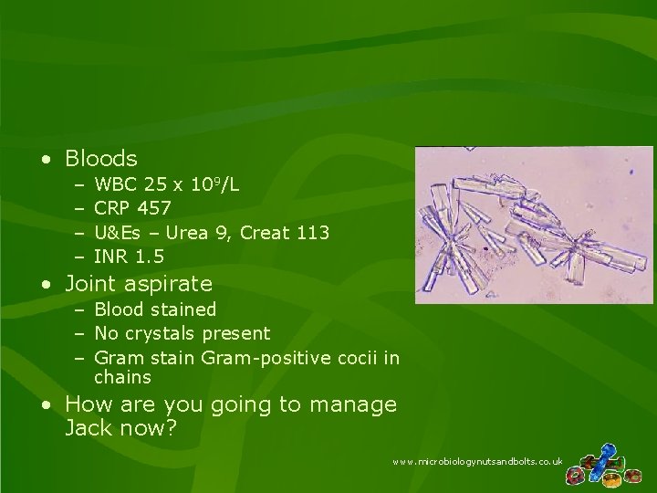  • Bloods – – WBC 25 x 109/L CRP 457 U&Es – Urea