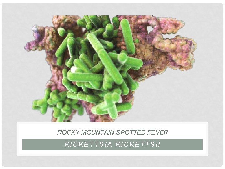 ROCKY MOUNTAIN SPOTTED FEVER RICKETTSIA RICKETTSII 