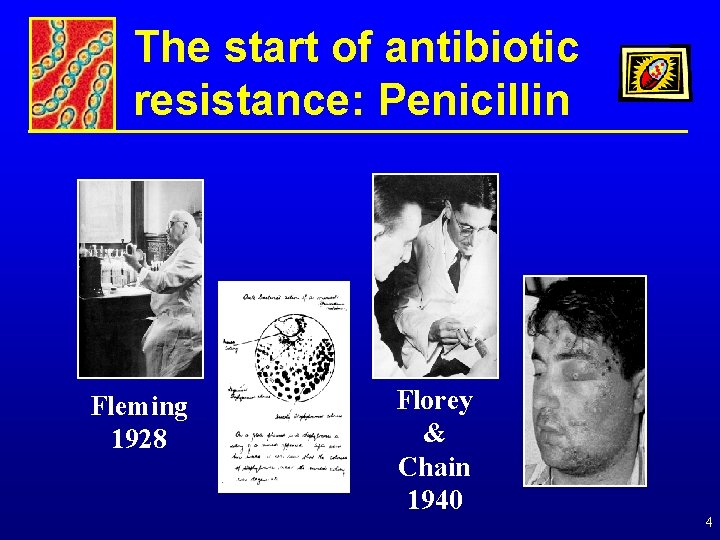 The start of antibiotic resistance: Penicillin Fleming 1928 Florey & Chain 1940 4 