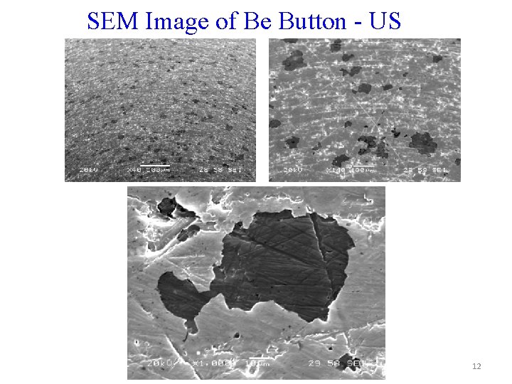 SEM Image of Be Button - US 12 