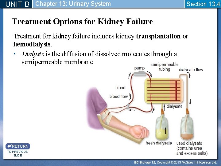 UNIT B Chapter 13: Urinary System Section 13. 4 Treatment Options for Kidney Failure