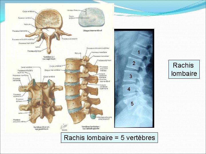 1 2 3 4 5 Rachis lombaire = 5 vertèbres Rachis lombaire 