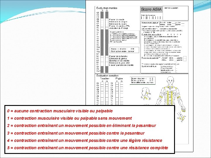 0 = aucune contraction musculaire visible ou palpable 1 = contraction musculaire visible ou