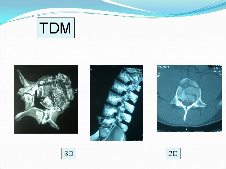 TDM 3 D 2 D 