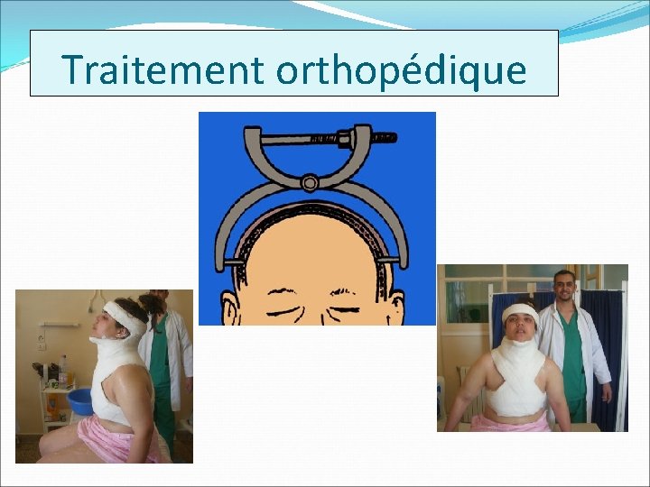 Traitement orthopédique 