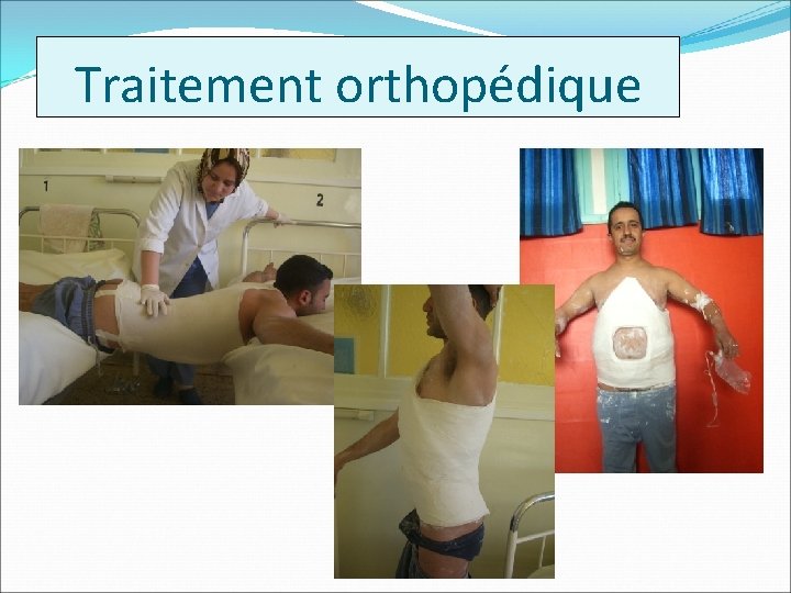 Traitement orthopédique 