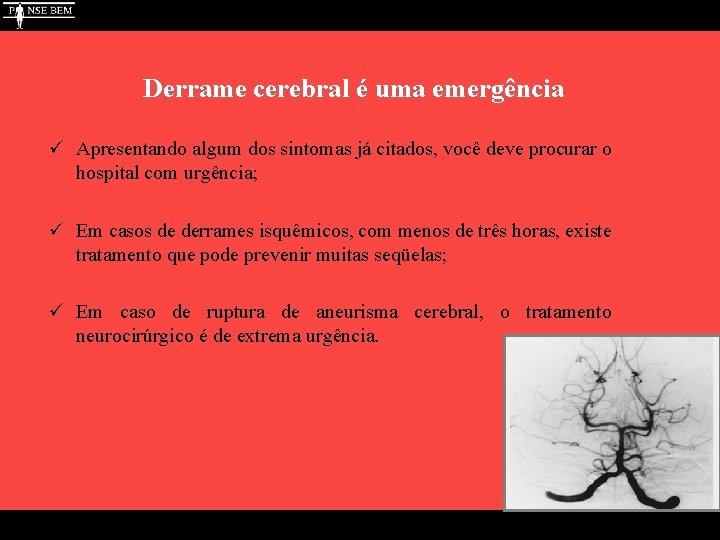 Derrame cerebral é uma emergência ü Apresentando algum dos sintomas já citados, você deve