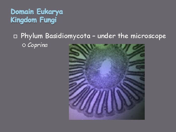 Domain Eukarya Kingdom Fungi Phylum Basidiomycota – under the microscope Coprina 