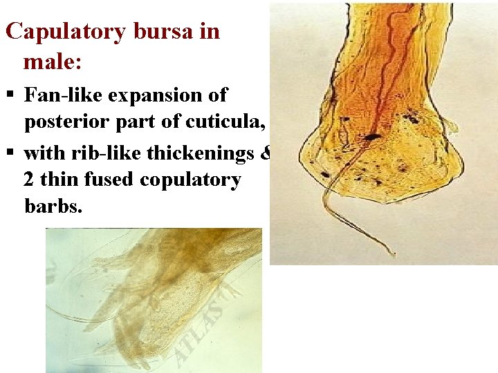 Capulatory bursa in male: § Fan-like expansion of posterior part of cuticula, § with