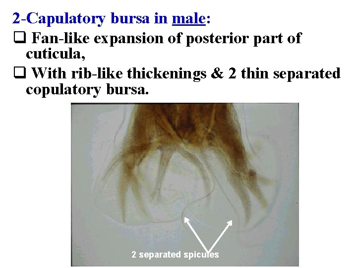 2 -Capulatory bursa in male: q Fan-like expansion of posterior part of cuticula, q