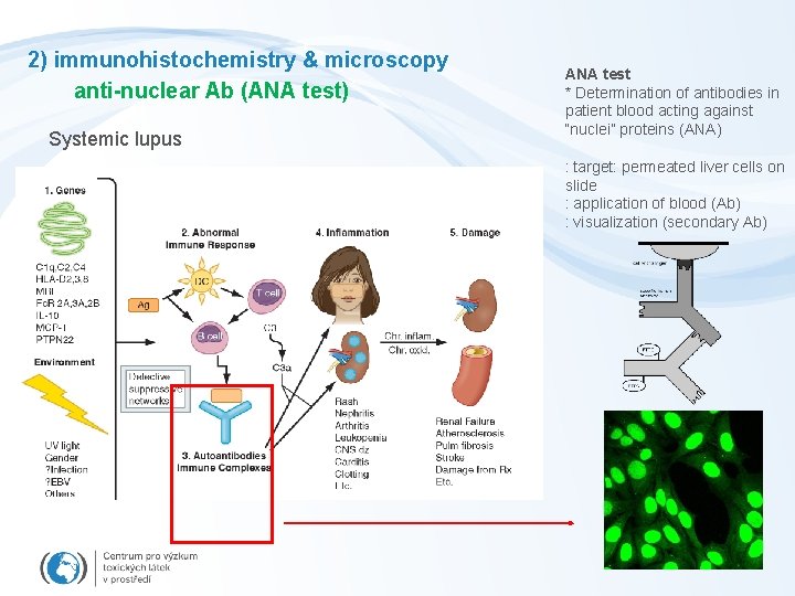 2) immunohistochemistry & microscopy anti-nuclear Ab (ANA test) Systemic lupus ANA test * Determination