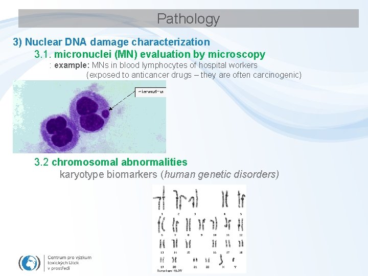 Pathology 3) Nuclear DNA damage characterization 3. 1. micronuclei (MN) evaluation by microscopy :