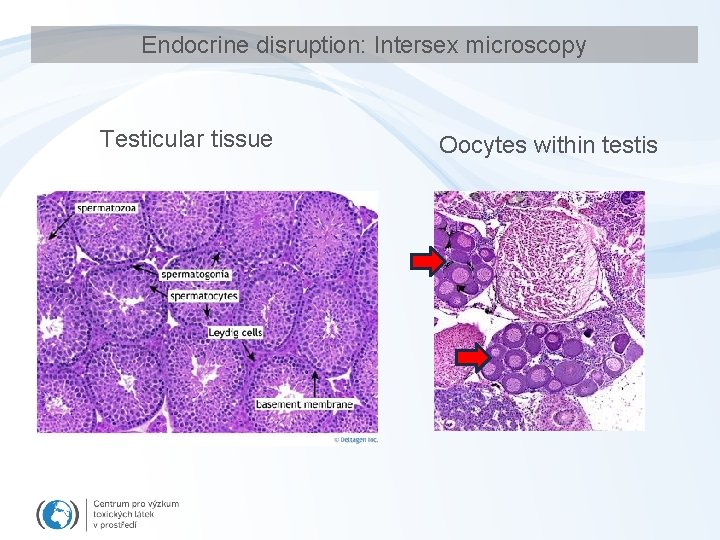 Endocrine disruption: Intersex microscopy Testicular tissue Oocytes within testis 