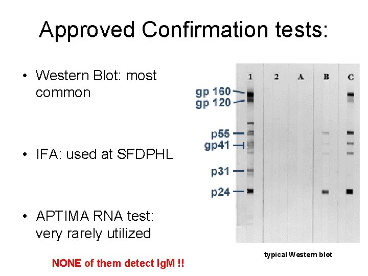 Approved Confirmation tests: • Western Blot: most common • IFA: used at SFDPHL •