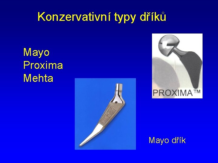 Konzervativní typy dříků Mayo Proxima Mehta Mayo dřík 