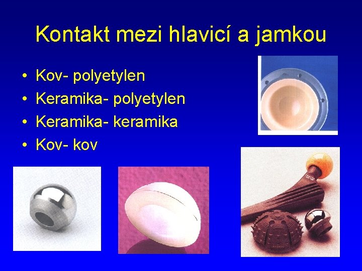 Kontakt mezi hlavicí a jamkou • • Kov- polyetylen Keramika- keramika Kov- kov 