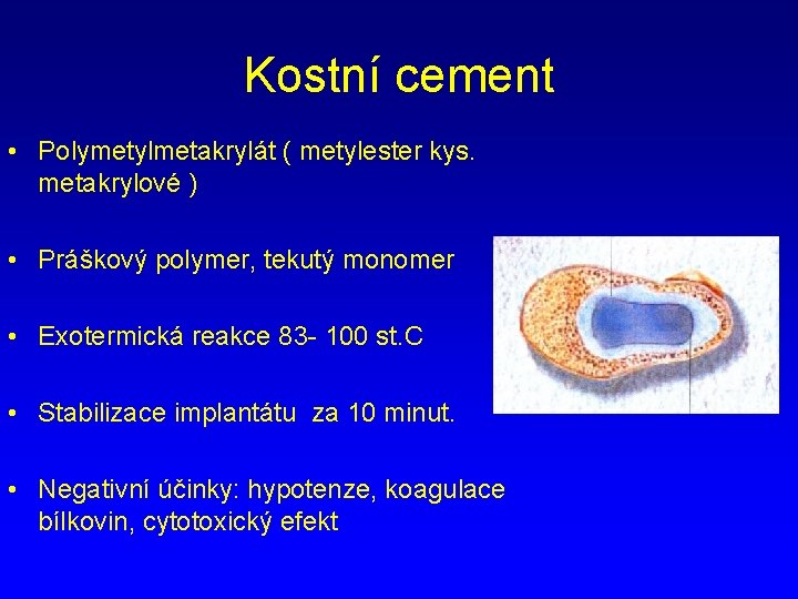 Kostní cement • Polymetylmetakrylát ( metylester kys. metakrylové ) • Práškový polymer, tekutý monomer