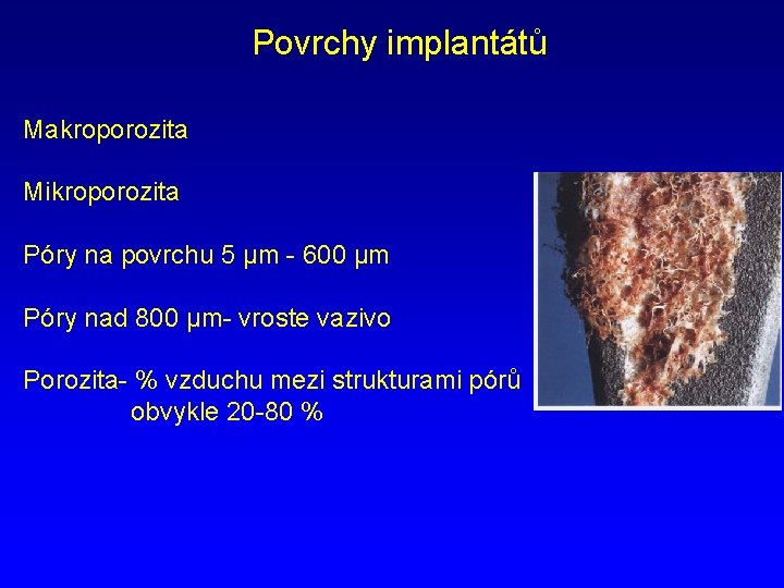 Povrchy implantátů Makroporozita Mikroporozita Póry na povrchu 5 µm - 600 µm Póry nad