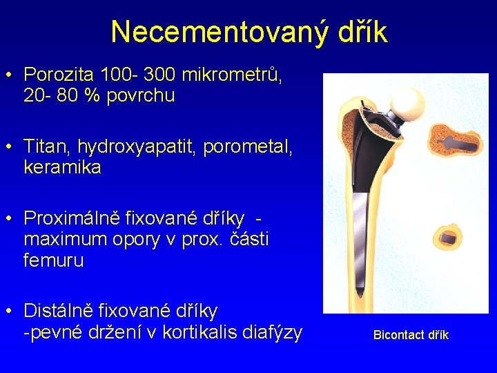 Necementovaný dřík • Porozita 100 - 300 mikrometrů, 20 - 80 % povrchu •