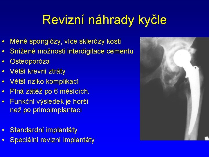 Revizní náhrady kyčle • • Méně spongiózy, více sklerózy kosti Snížené možnosti interdigitace cementu