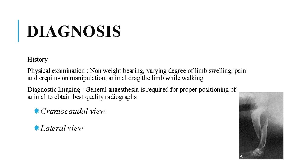 DIAGNOSIS History Physical examination : Non weight bearing, varying degree of limb swelling, pain