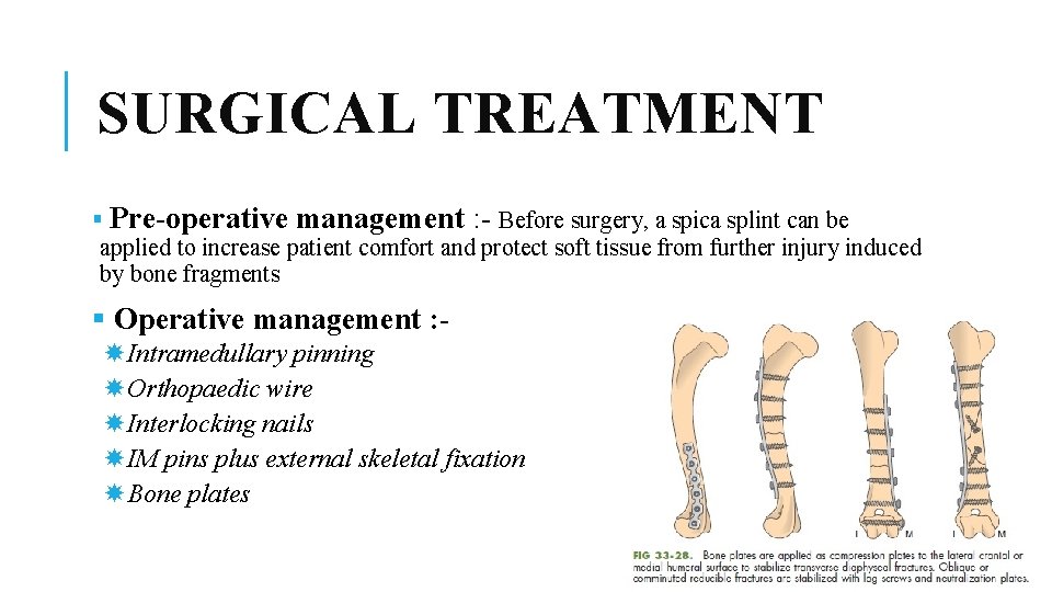 SURGICAL TREATMENT § Pre-operative management : - Before surgery, a spica splint can be