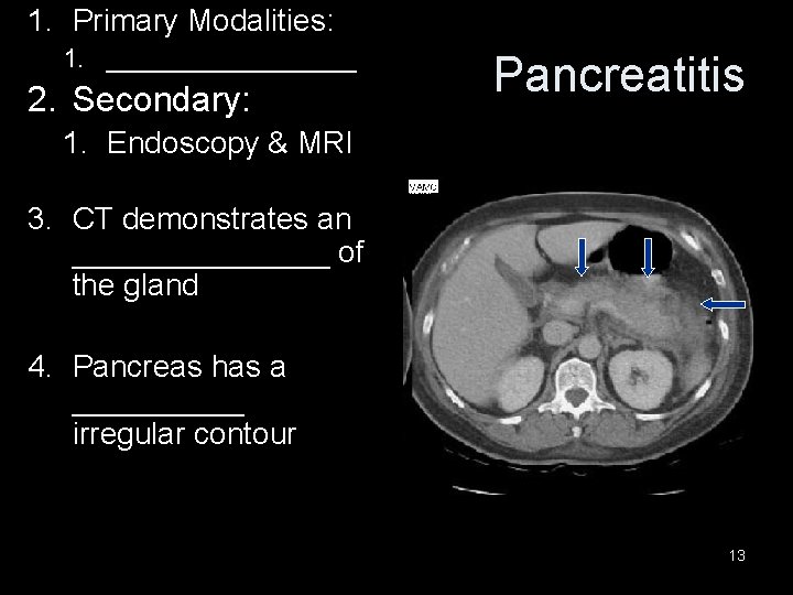 1. Primary Modalities: 1. _________ 2. Secondary: Pancreatitis 1. Endoscopy & MRI 3. CT