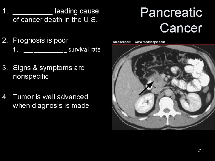 1. _____ leading cause of cancer death in the U. S. Pancreatic Cancer 2.