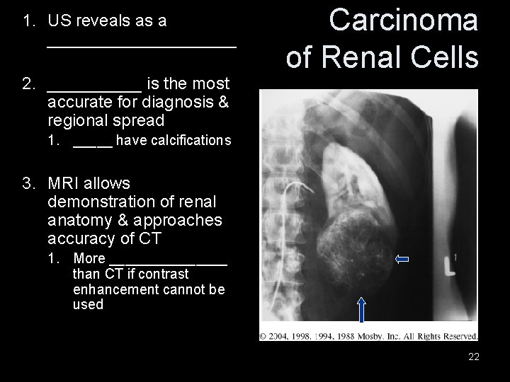 1. US reveals as a __________ 2. _____ is the most accurate for diagnosis