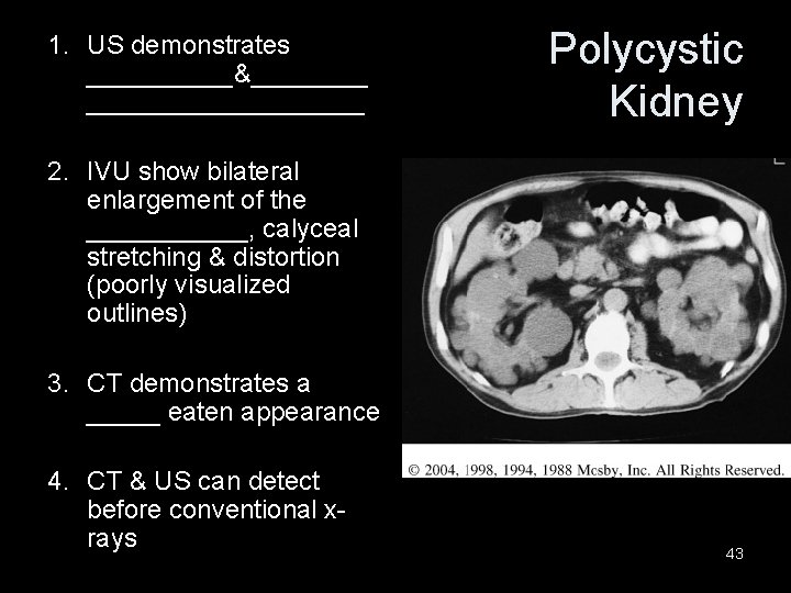 1. US demonstrates _____&__________ Polycystic Kidney 2. IVU show bilateral enlargement of the ______,