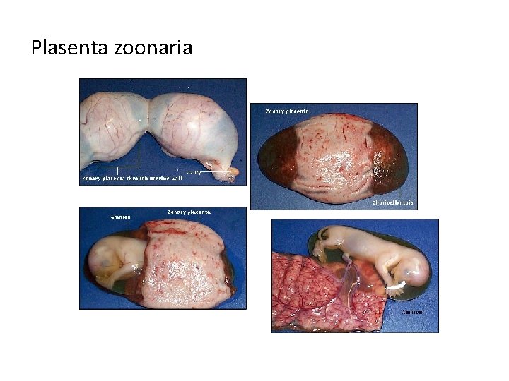 Plasenta zoonaria 