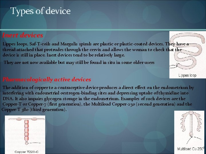 Types of device Inert devices Lippes loops, Saf T coils and Margulis spirals are