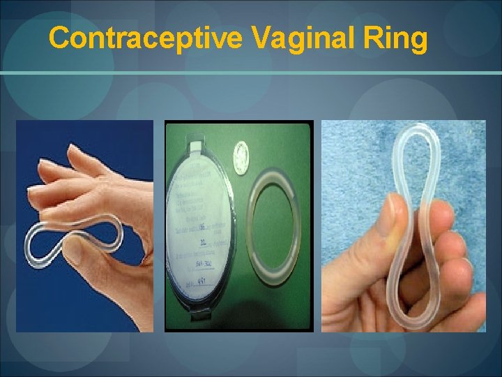 Contraceptive Vaginal Ring 