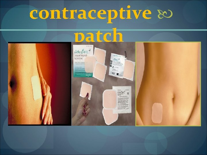 contraceptive patch 